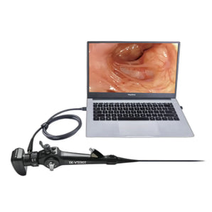 Système d'endoscopie USB portable vétérinaire série EU