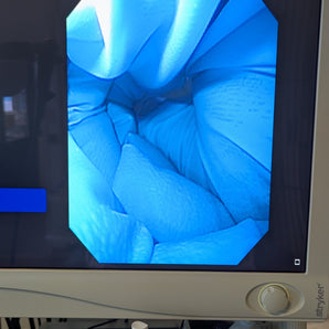 Gastroscope OLYMPUS GIF-140